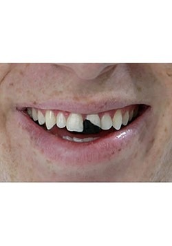 Tooth Wax